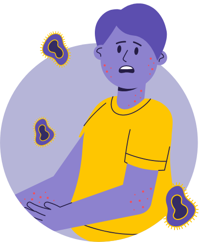 Illustration of person surrounded by germs and showing symptoms of Mpox